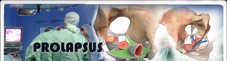 prolapsus