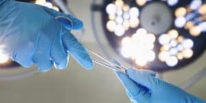 Opération gynécologique - Hystérectomie par voie basse à Nice